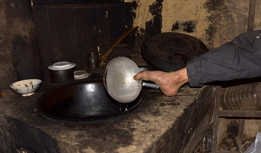 lost-arms-man-feed-sick-mother-teeth-chen-xinyin-16 lost-arms-man-feed-sick-mother-teeth-chen-xinyin-16