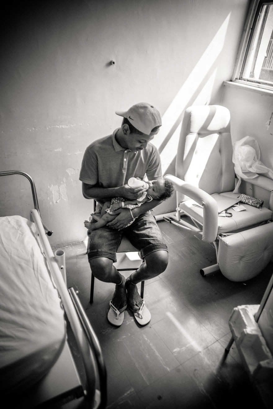 Conjoined Twins After Separation Surgery