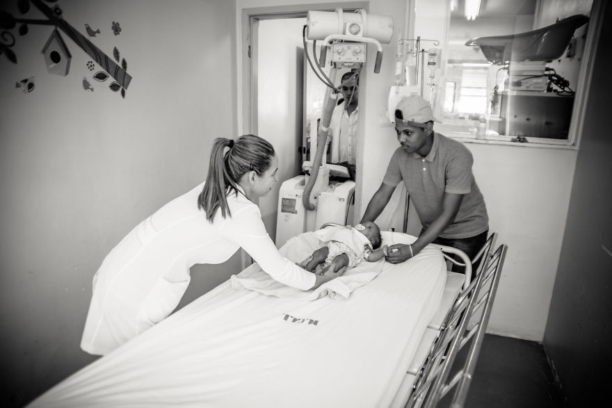 Conjoined Twins After Separation Surgery