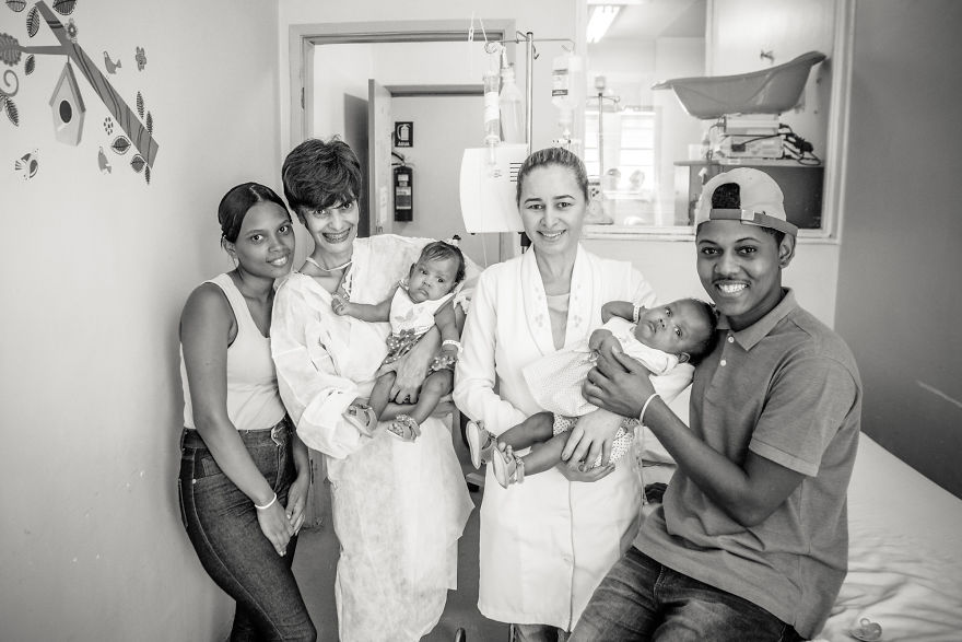 Conjoined Twins After Separation Surgery Conjoined Twins After Separation Surgery