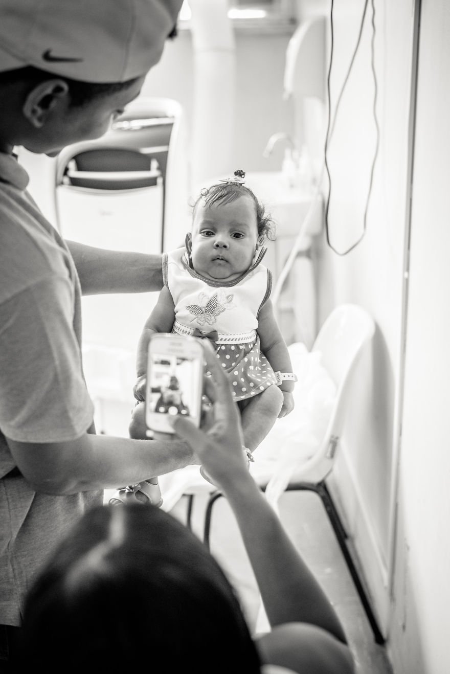 Conjoined Twins After Separation Surgery Conjoined Twins After Separation Surgery