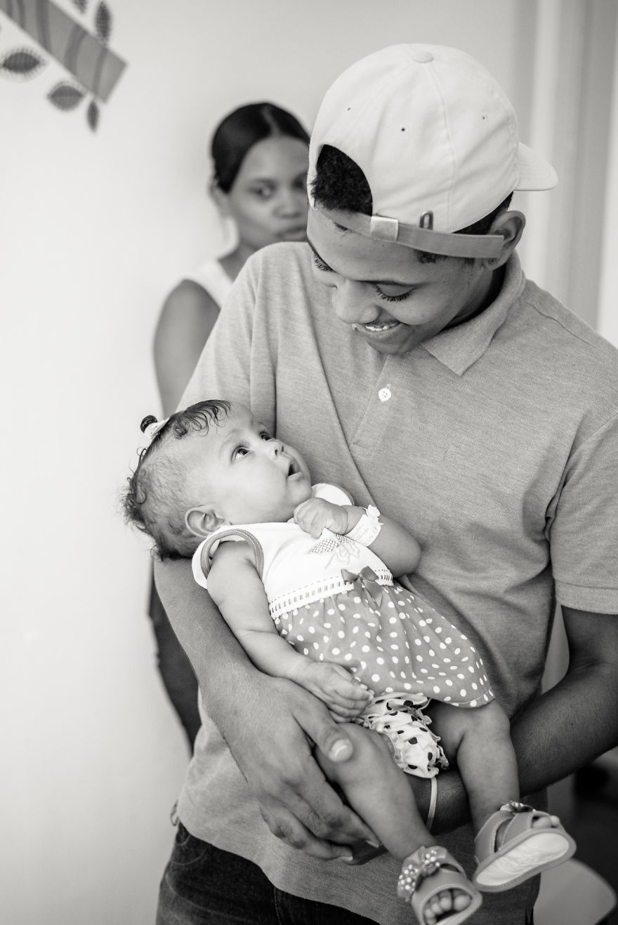 Conjoined Twins After Separation Surgery