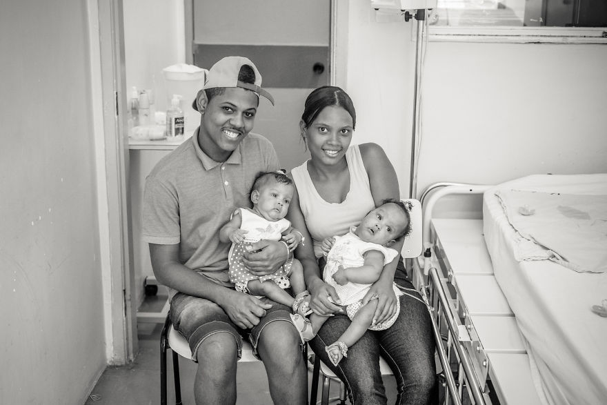 Conjoined Twins After Separation Surgery Conjoined Twins After Separation Surgery