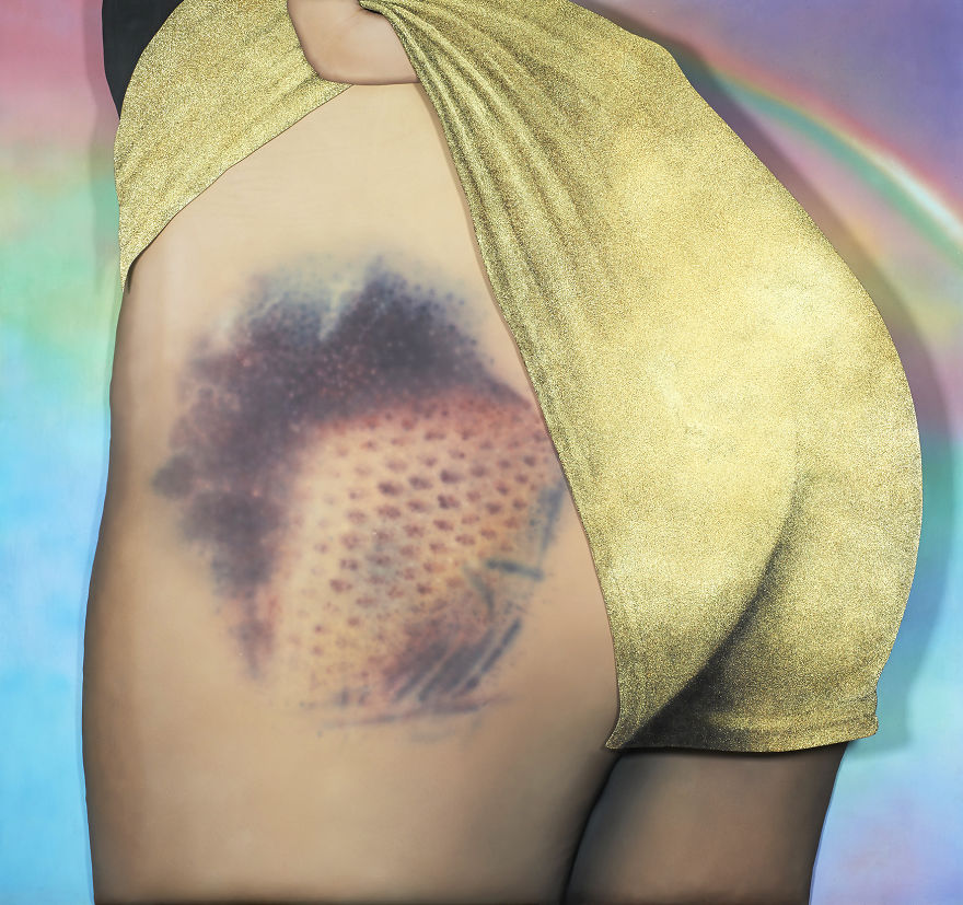 The Beauty Of Bruises: I Captured These Mini-Galaxies On The Butts Of Rolle...