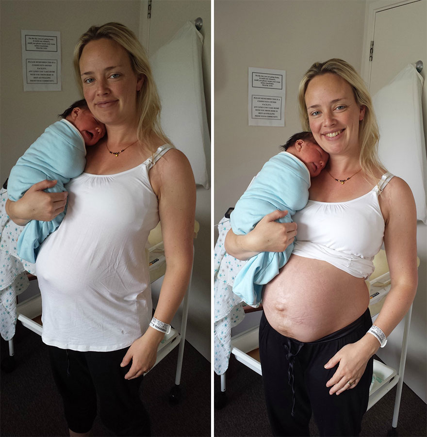 My Real Postpartum Body: I Want Every Mom To Know That It's Normal And You're Beautiful My Real Postpartum Body: I Want Every Mom To Know That It's Normal And You're Beautiful