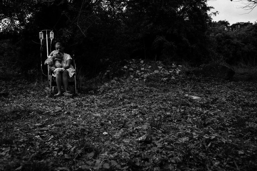 The Diary Of A Bald Girl In The Final Stage Of Cancer The Diary Of A Bald Girl In The Final Stage Of Cancer