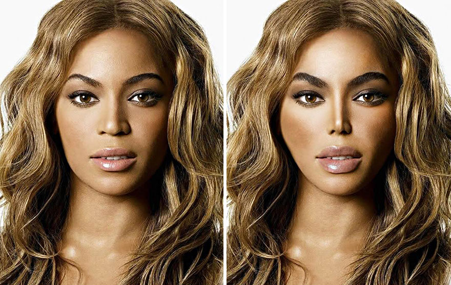 What If These Celebrities Became Obsessed With Fake Beauty And Stereotypical Plastic Surgeries ?