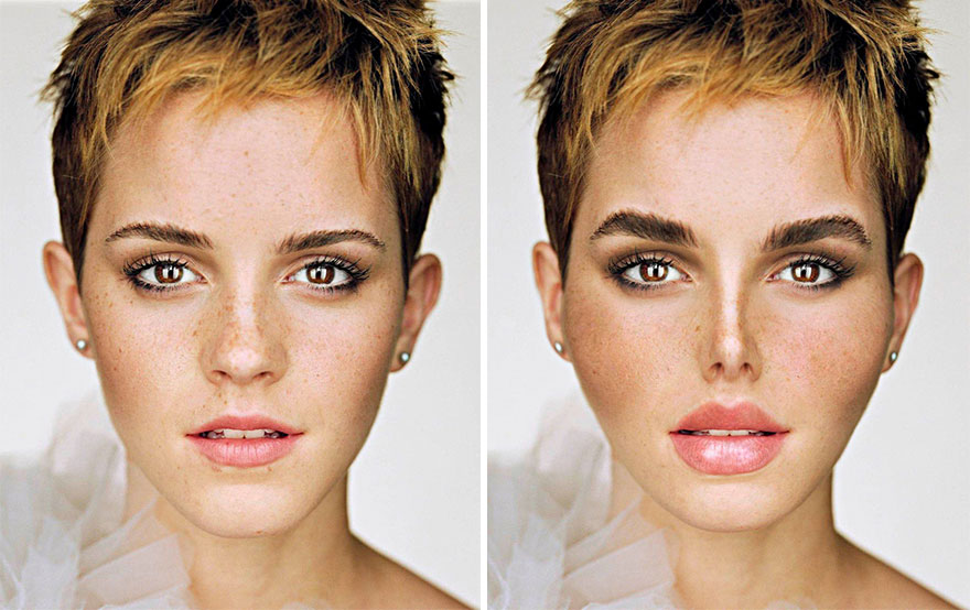 What If These Celebrities Became Obsessed With Fake Beauty And Stereotypical Plastic Surgeries ?