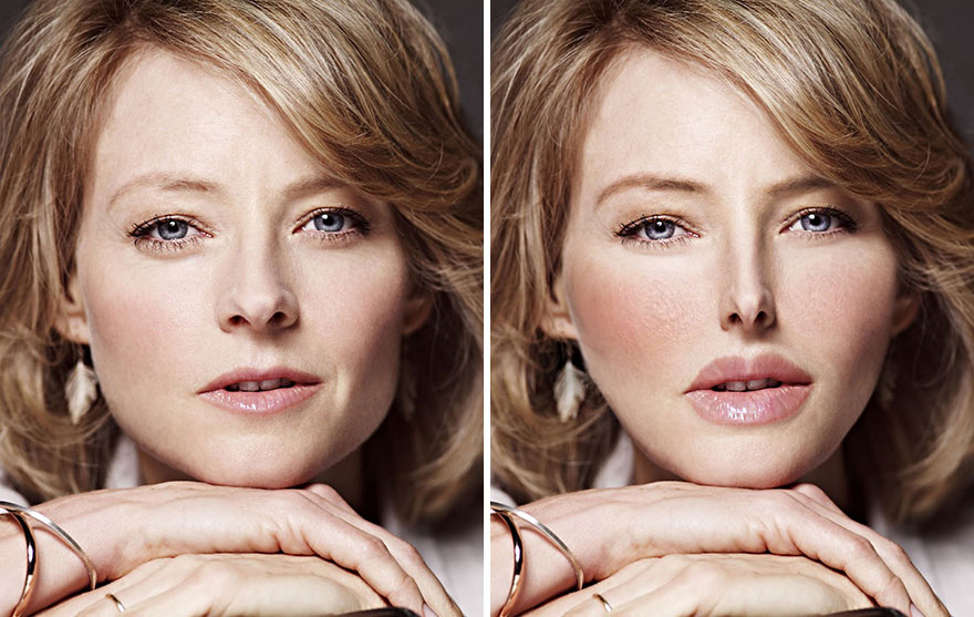 What If These Celebrities Became Obsessed With Fake Beauty And Stereotypical Plastic Surgeries ?