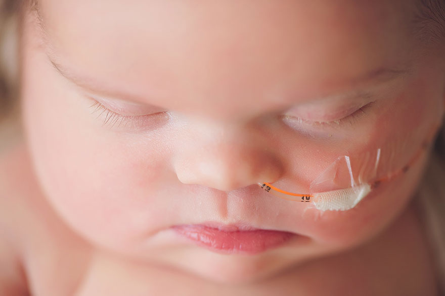 baby-terminal-brain-tumor-cancer-down-syndrome-family-photos-abigail-jones-28