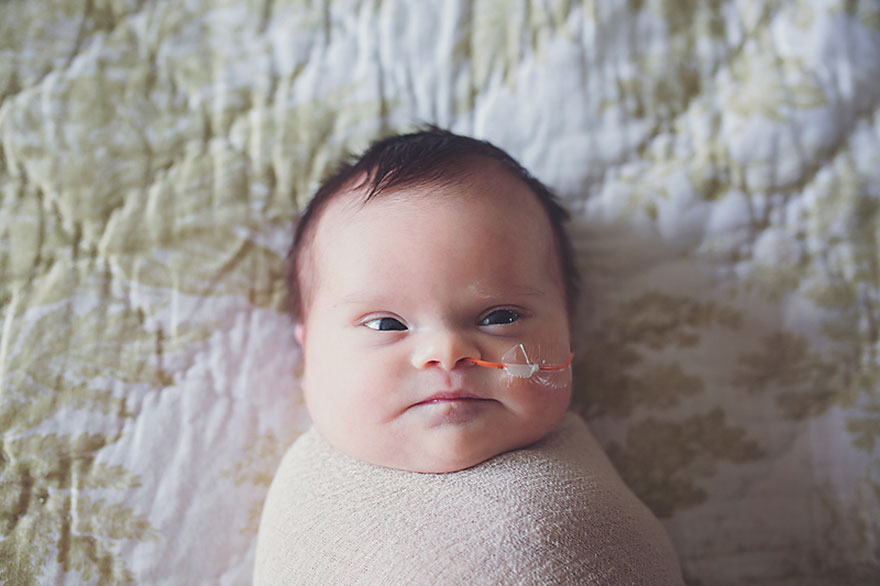 baby-terminal-brain-tumor-cancer-down-syndrome-family-photos-abigail-jones-7