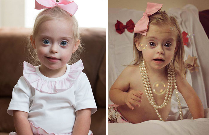 2-Year-Old Girl With Down Syndrome Wins Modeling Contract Thanks To Her Cheeky Smile