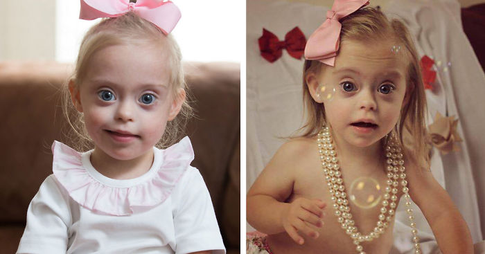 2-Year-Old Girl With Down Syndrome Wins Modeling Contract Thanks To Her Cheeky Smile