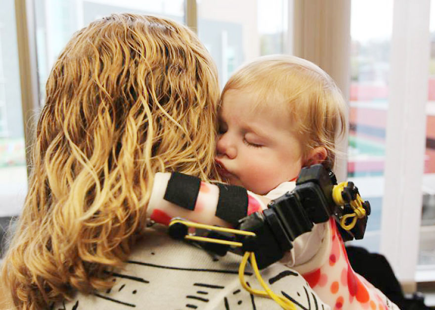 Magic Arms: 3D-Printed Device Helps People With Rare Conditions Move Their Arms Magic Arms: 3D-Printed Device Helps People With Rare Conditions Move Their Arms