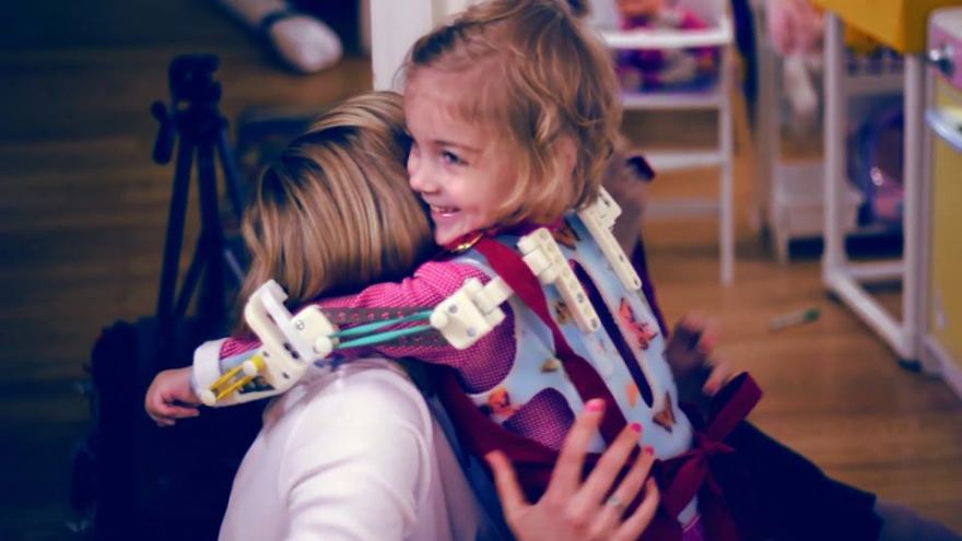 Magic Arms: 3D-Printed Device Helps People With Rare Conditions Move Their Arms Magic Arms: 3D-Printed Device Helps People With Rare Conditions Move Their Arms