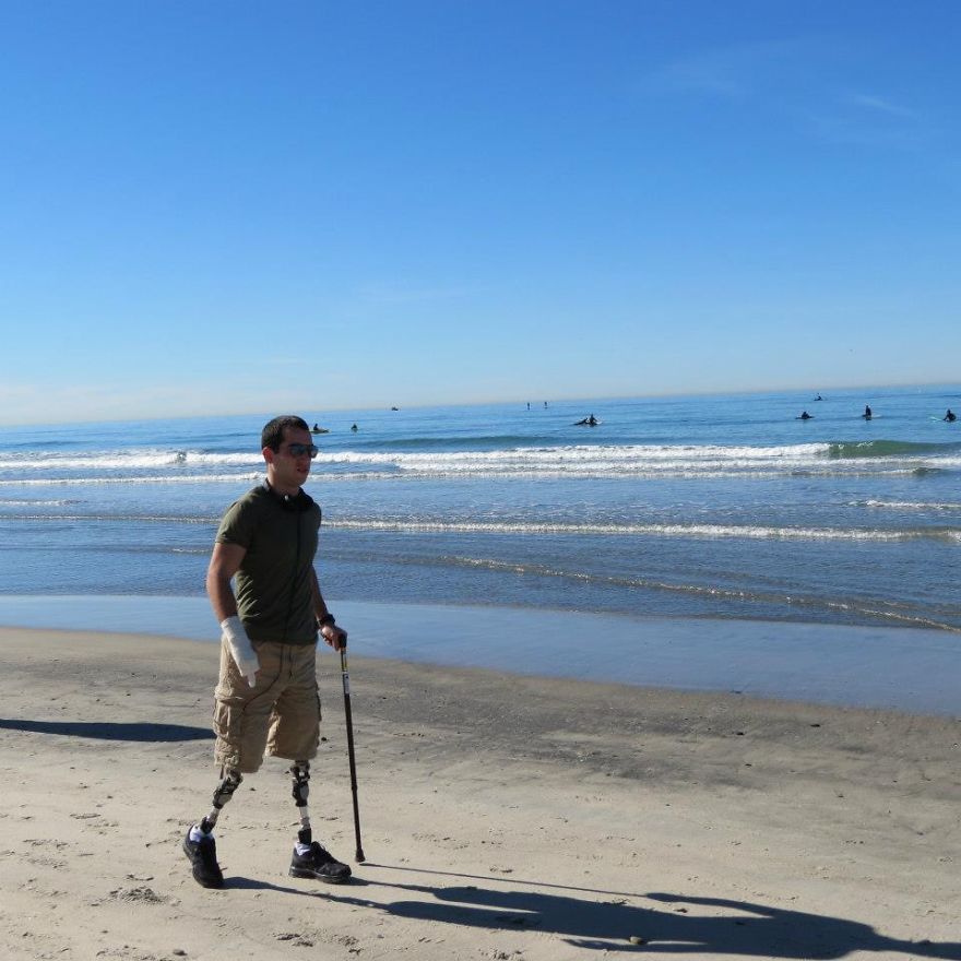 Inspiring Story Of A Double Amputee Soldier Who Doesn't Let The Injury Stand In His Way