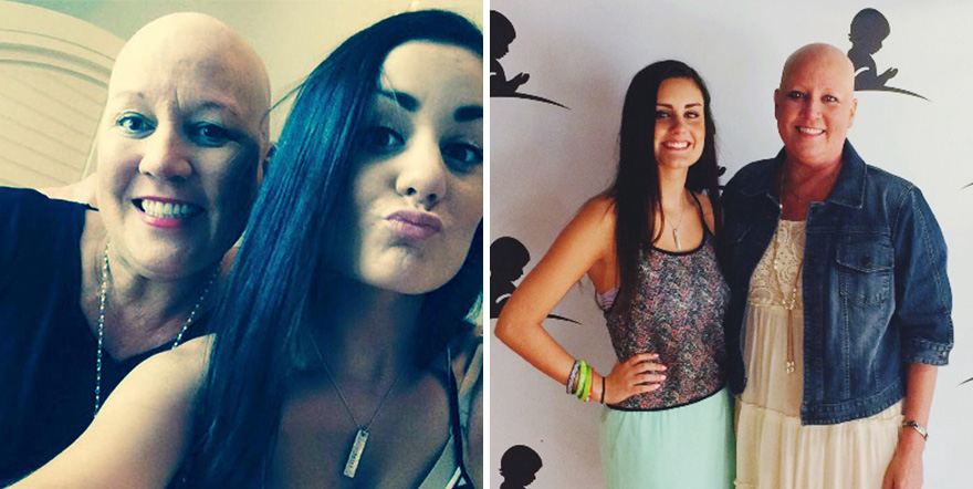 brain-cancer-allie-allen-shaved-head-brayden-carpenter-homecoming-6