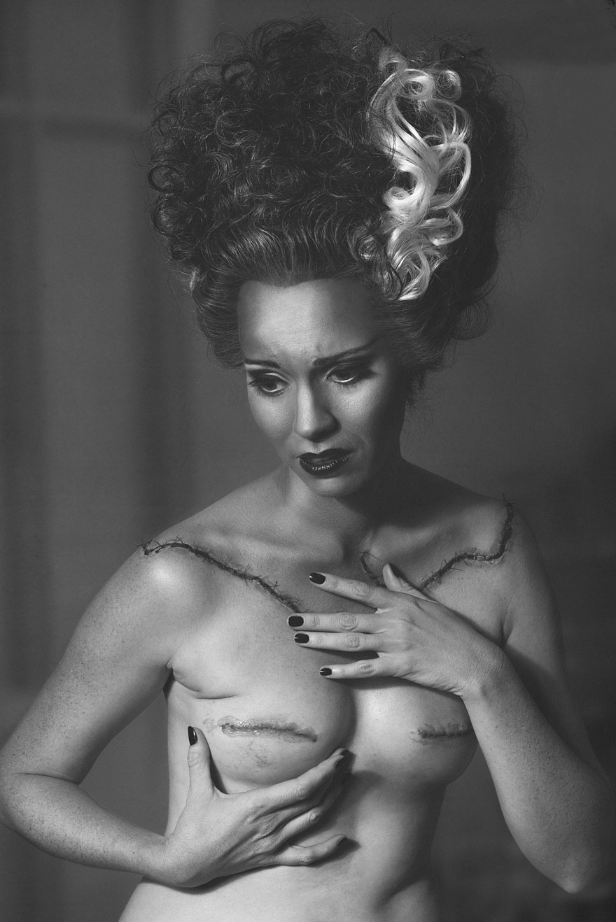 cancer-mastectomy-photos-my-breast-choice-aniela-mcguinness-3 cancer-mastectomy-photos-my-breast-choice-aniela-mcguinness-3