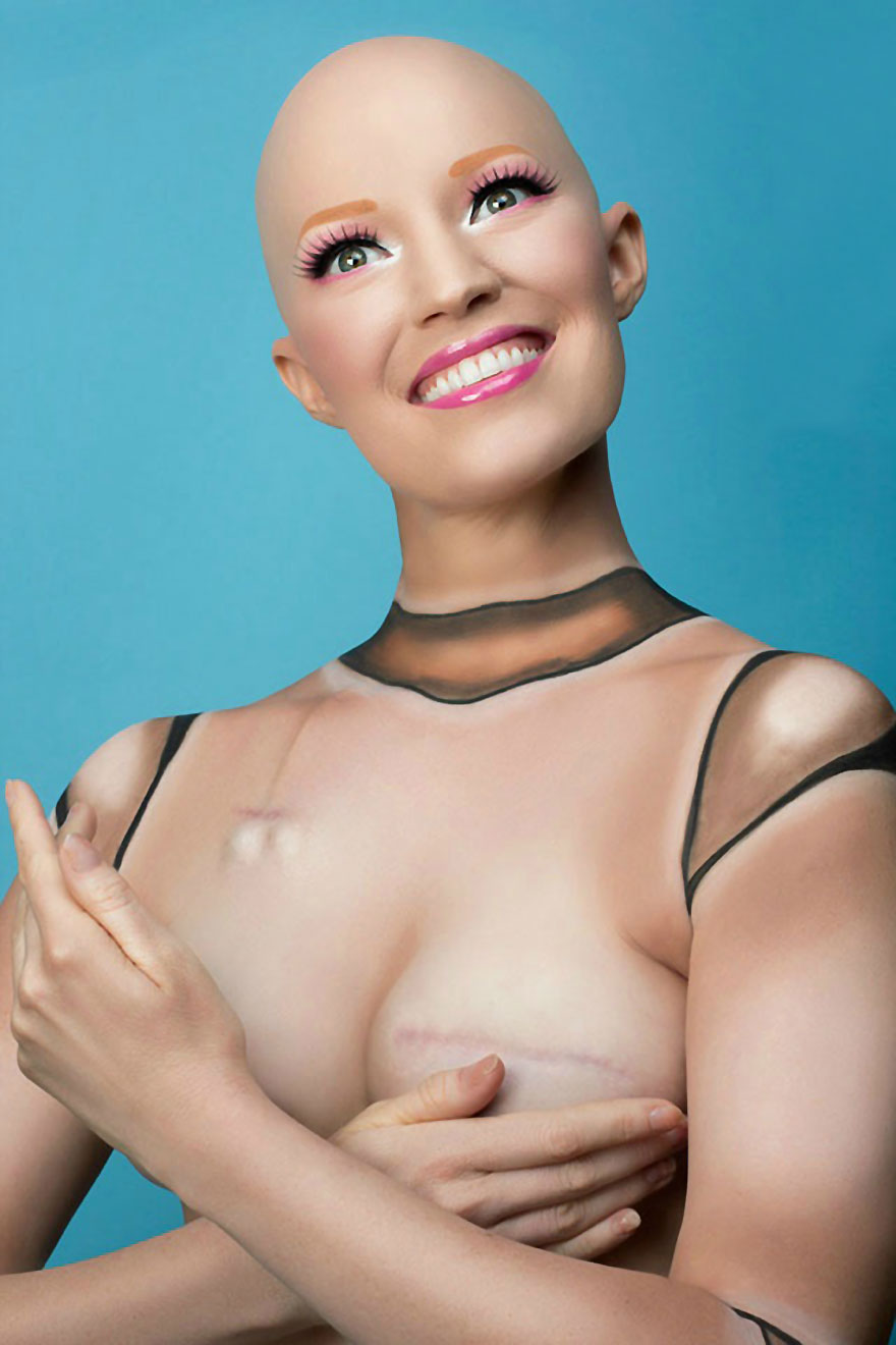 cancer-mastectomy-photos-my-breast-choice-aniela-mcguinness-5