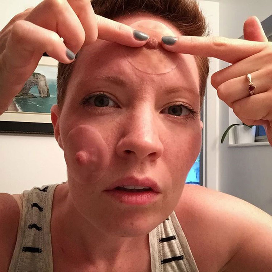 cancer-mastectomy-photos-my-breast-choice-aniela-mcguinness-7