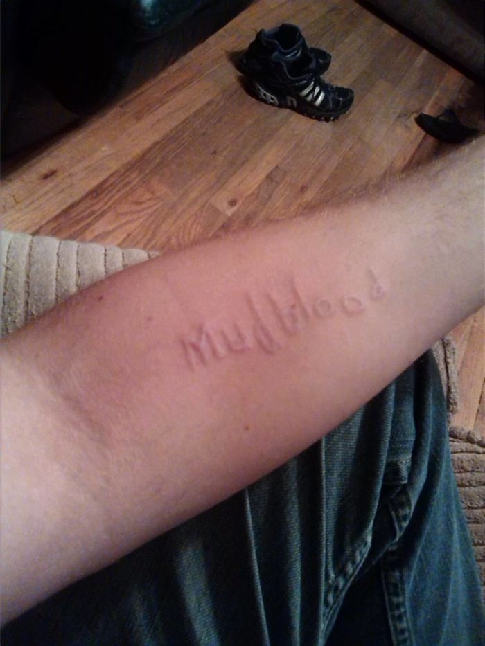 Arm featuring a subtle Harry Potter tattoo with the word "Mudblood" etched in skin tone.
