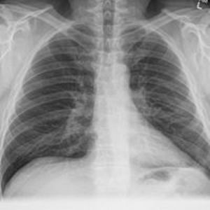 mark_reiman55 avatar