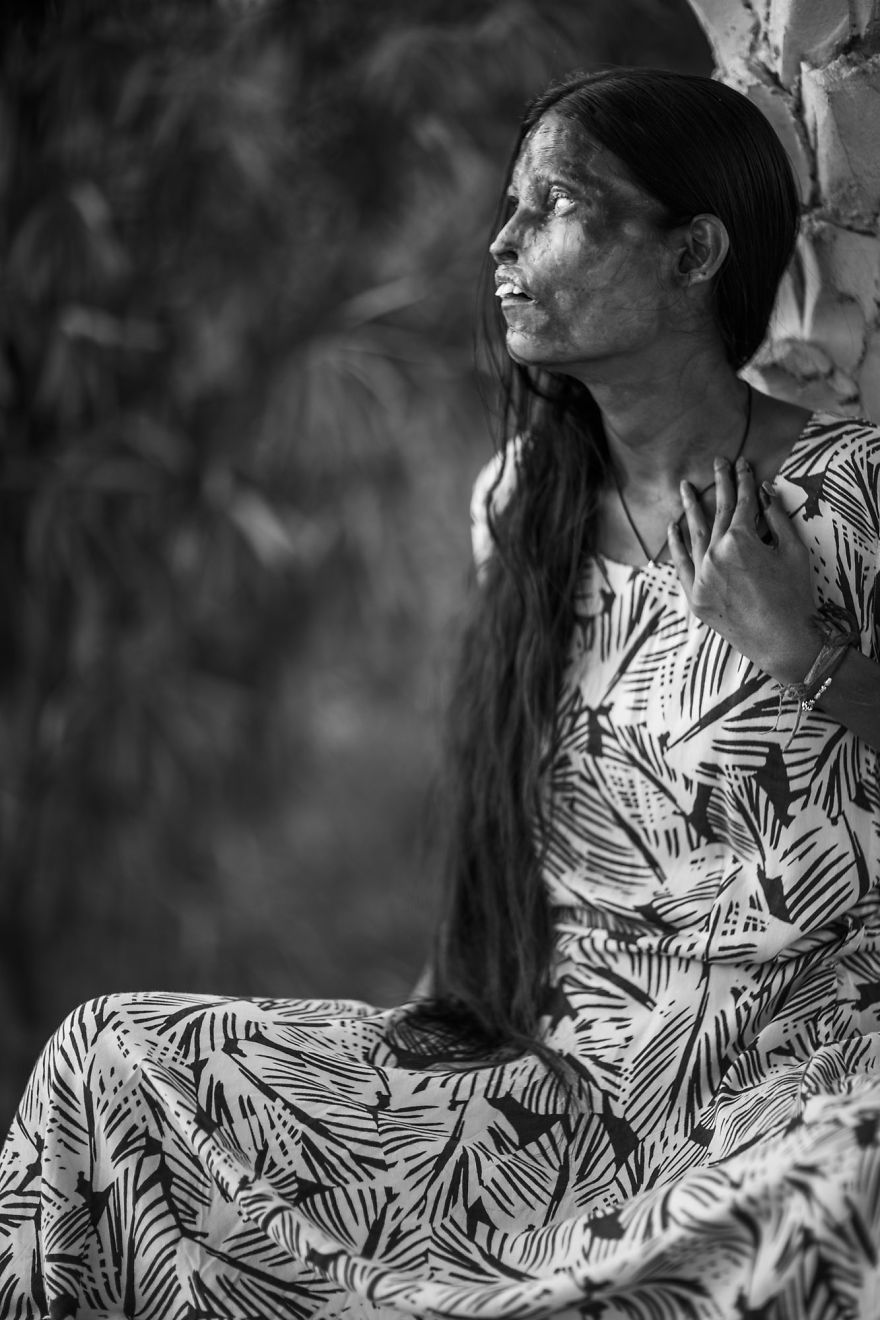 I Took Portraits Of Acid Attacks Survivors In India I Took Portraits Of Acid Attacks Survivors In India