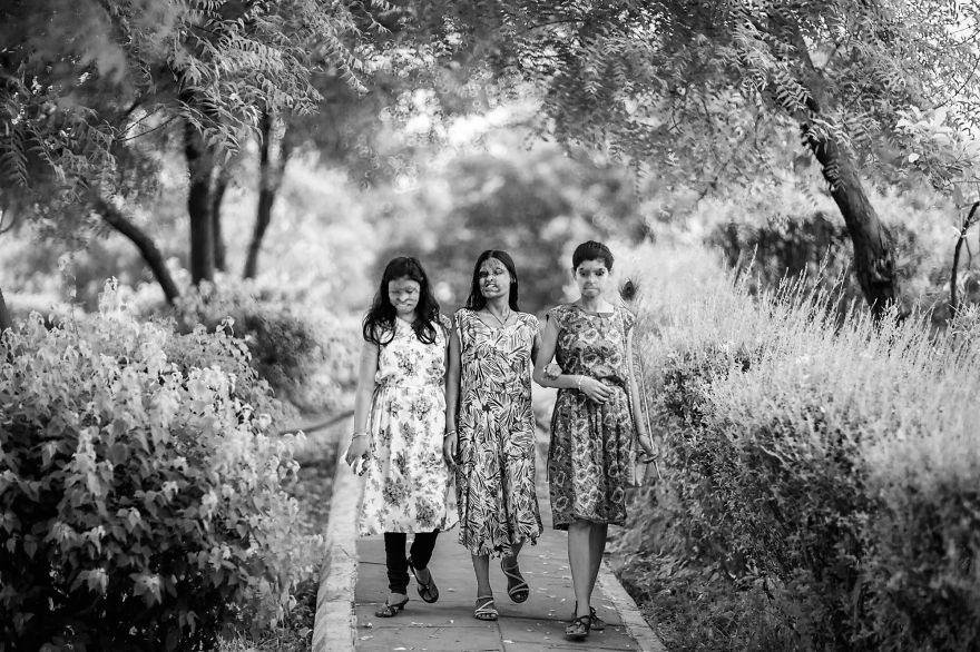 I Took Portraits Of Acid Attacks Survivors In India I Took Portraits Of Acid Attacks Survivors In India