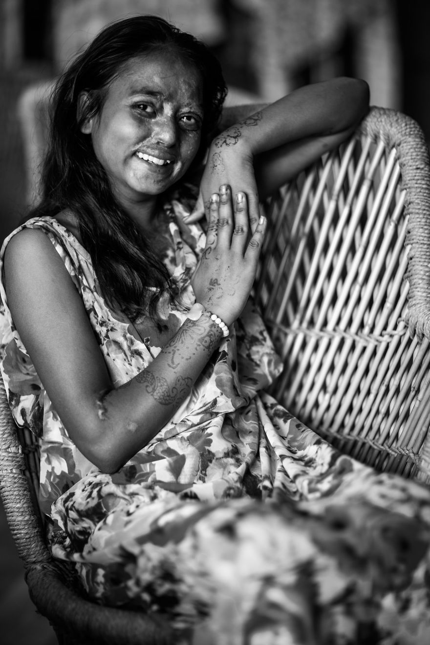 I Took Portraits Of Acid Attacks Survivors In India I Took Portraits Of Acid Attacks Survivors In India