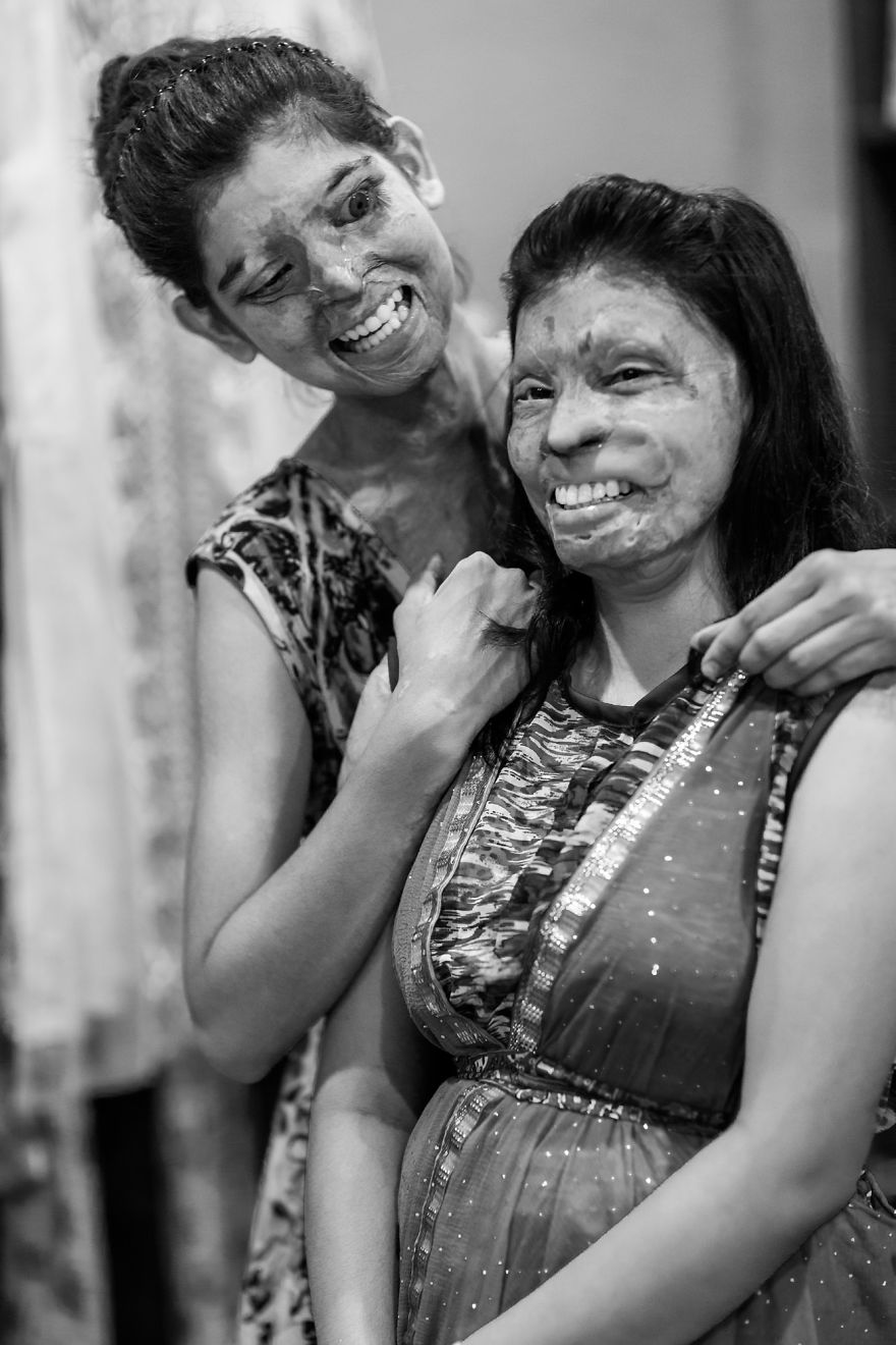 I Took Portraits Of Acid Attacks Survivors In India I Took Portraits Of Acid Attacks Survivors In India