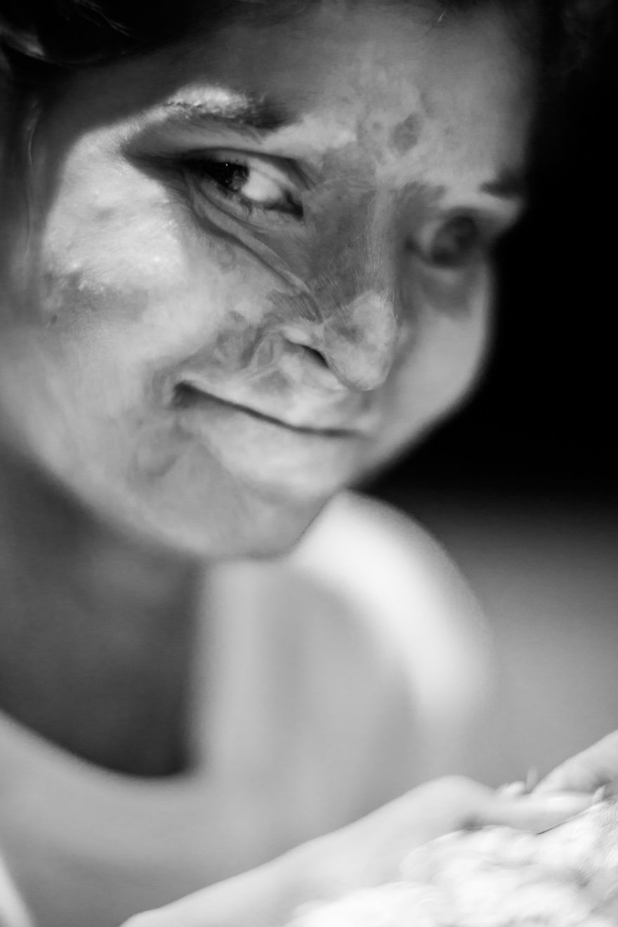 I Took Portraits Of Acid Attacks Survivors In India I Took Portraits Of Acid Attacks Survivors In India
