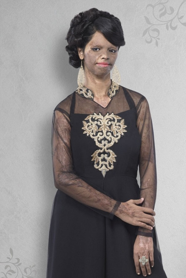 acid-attack-survivor-laxmi-fashion-model-india-21 acid-attack-survivor-laxmi-fashion-model-india-21