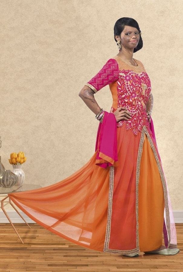 acid-attack-survivor-laxmi-fashion-model-india-25