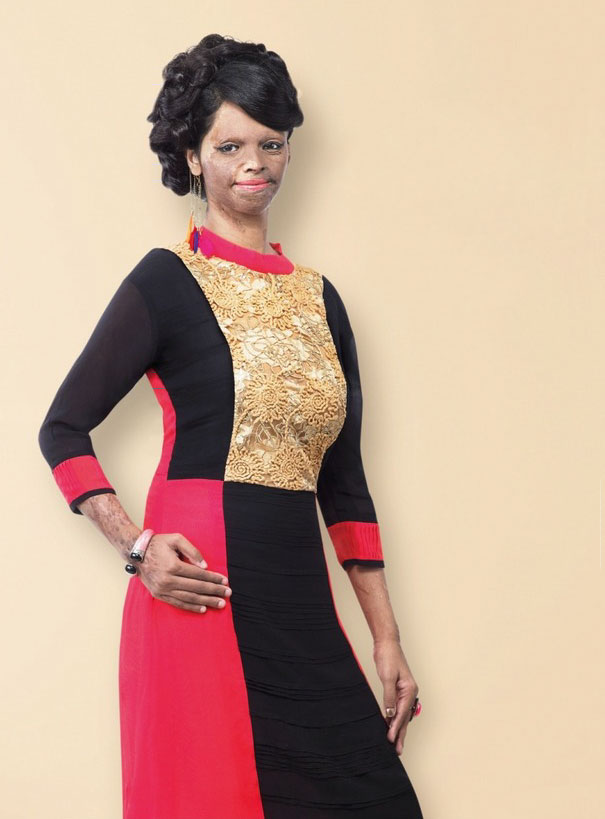 acid-attack-survivor-laxmi-fashion-model-india-26 acid-attack-survivor-laxmi-fashion-model-india-26