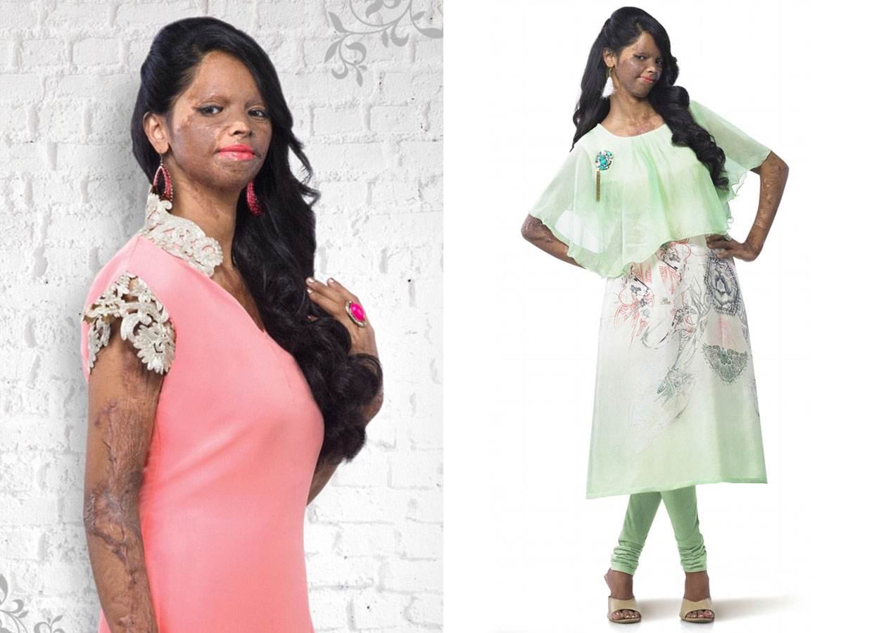 Acid Attack Survivor Becomes Face Of Fashion Brand In India