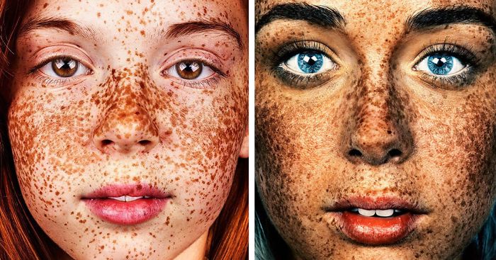 Unique Beauty Of Freckled People Documented By Brock Elbank