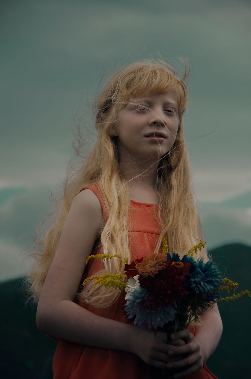 I Had The Chance To Photograph The Beauty Of An Albino