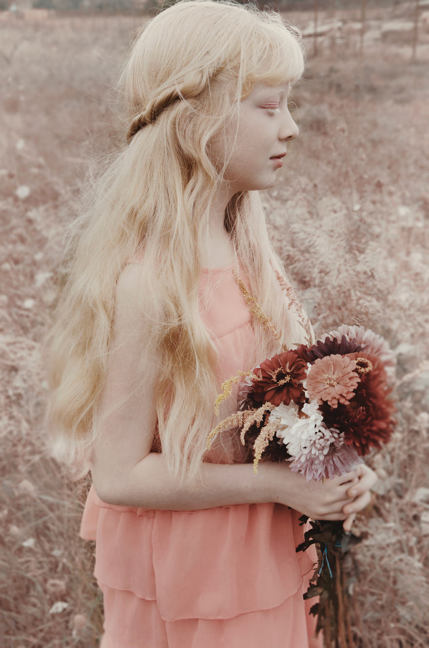 I Had The Chance To Photograph The Beauty Of An Albino