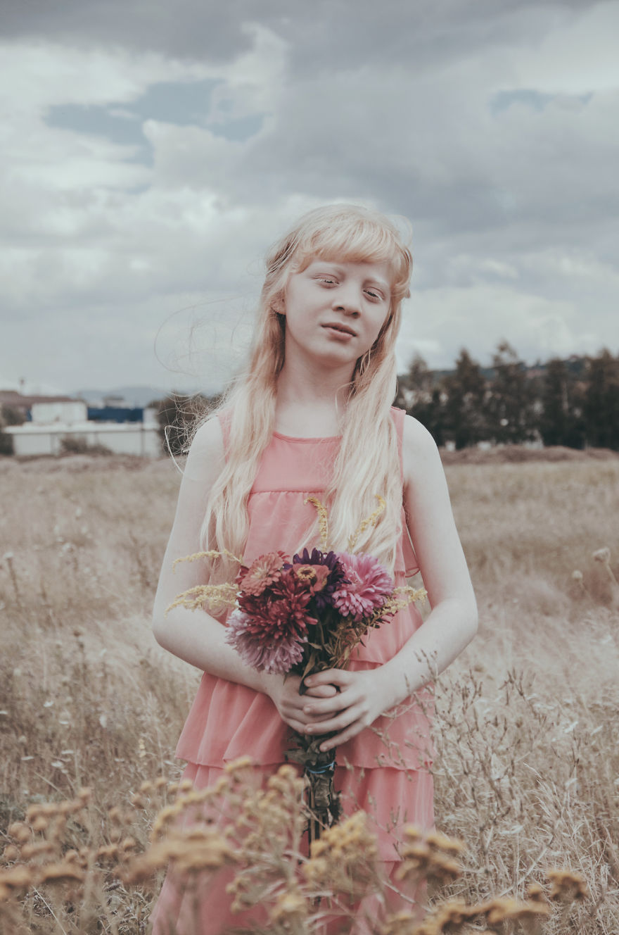 I Had The Chance To Photograph The Beauty Of An Albino