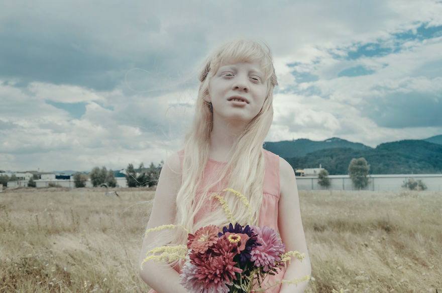 I Had The Chance To Photograph The Beauty Of An Albino