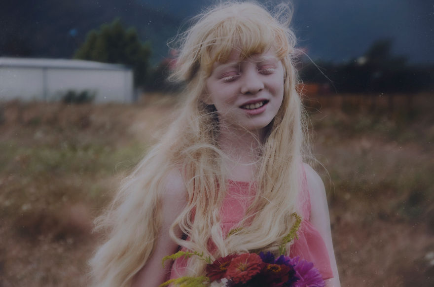 I Had The Chance To Photograph The Beauty Of An Albino