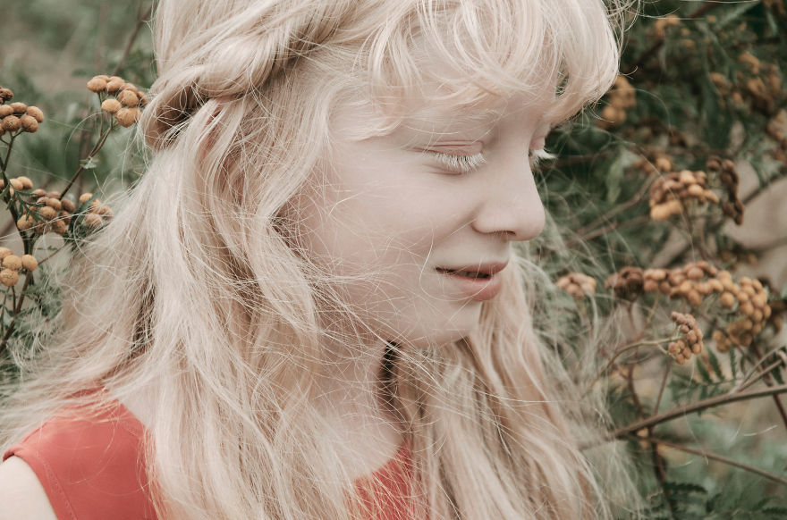 I Had The Chance To Photograph The Beauty Of An Albino
