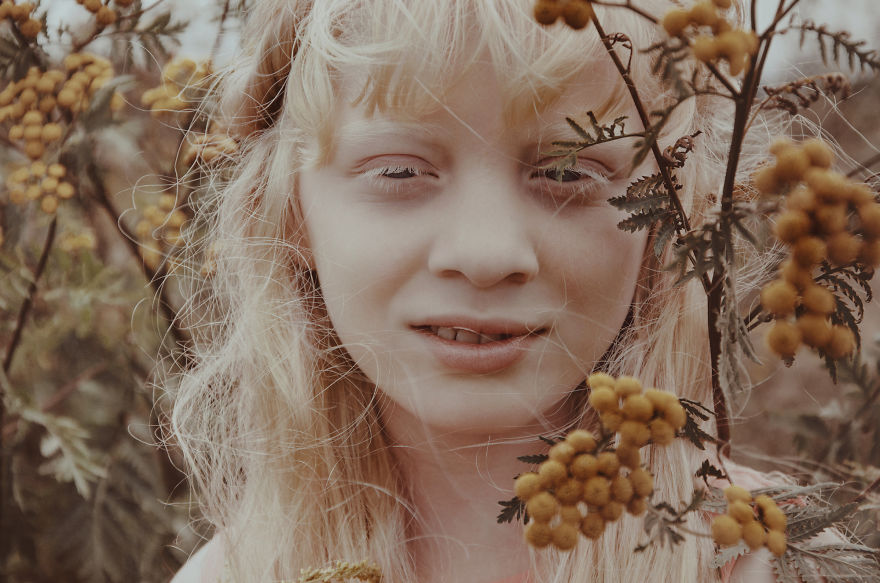 I Had The Chance To Photograph The Beauty Of An Albino