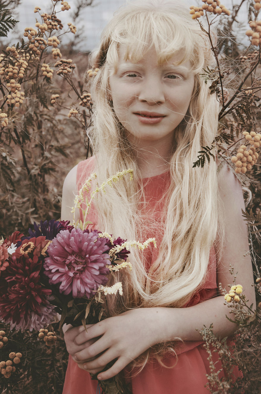 I Had The Chance To Photograph The Beauty Of An Albino