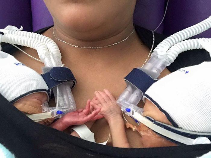 premature-birth-twins-hold-hands-babies-anthea-jackson-rushford-2