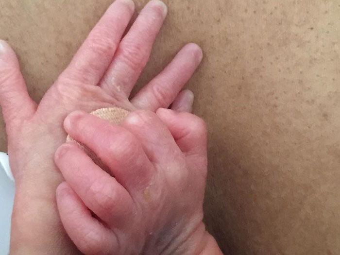 premature-birth-twins-hold-hands-babies-anthea-jackson-rushford-3