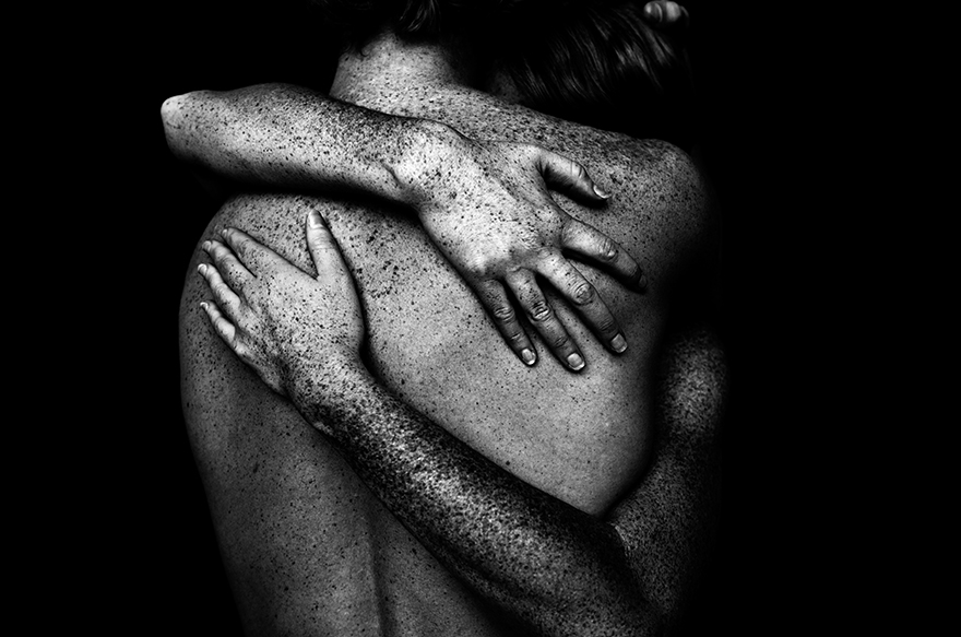 We Are Freckled: Swedish Photographer Captured 100+ Beautifully Freckled People