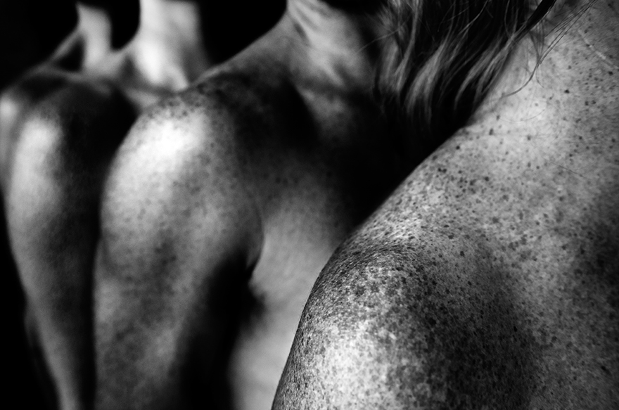 We Are Freckled: Swedish Photographer Captured 100+ Beautifully Freckled People