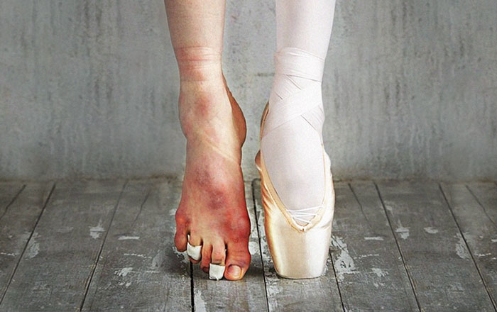 The Cost Of Applause: 77 Pics To Celebrate Ballet Day