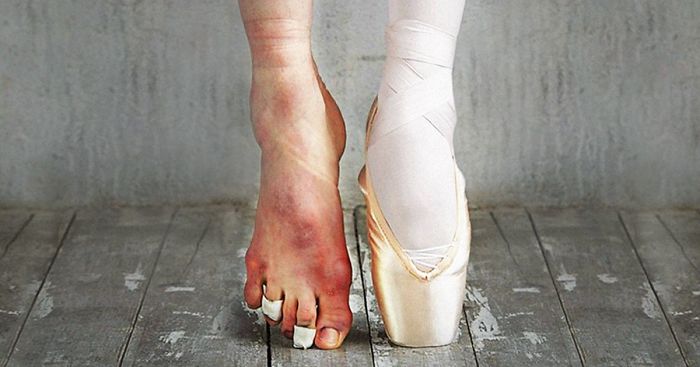 The Cost Of Applause: 77 Pics To Celebrate Ballet Day